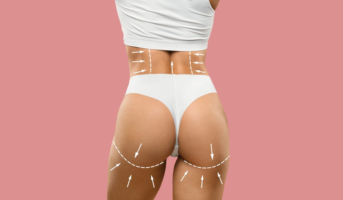 Brazilian Butt Lift (BBL) Marketing