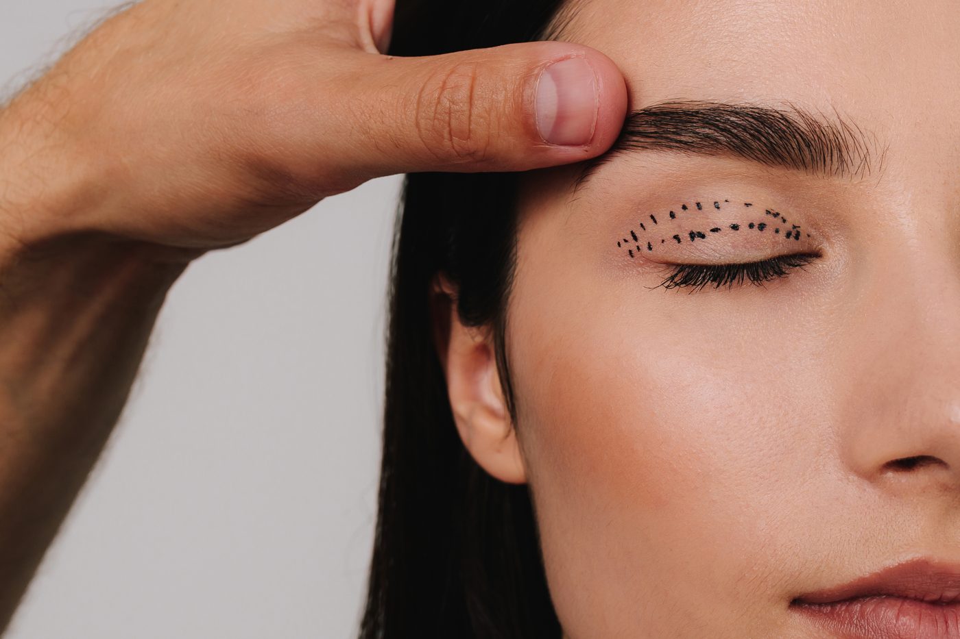 Eyelid Surgery Marketing