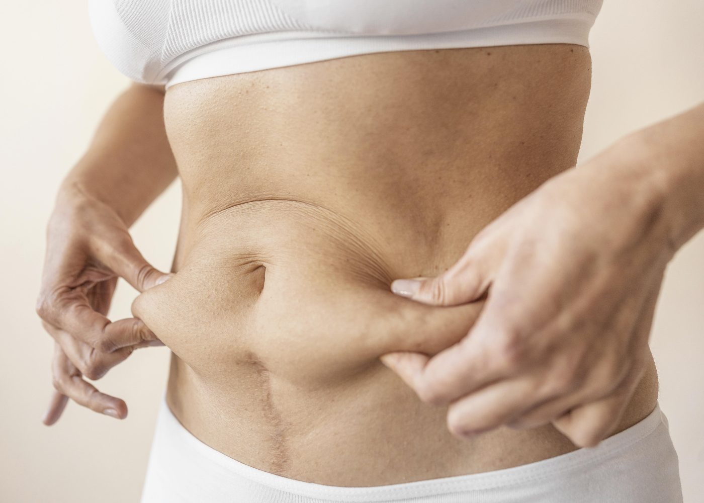 Tummy Tuck Marketing